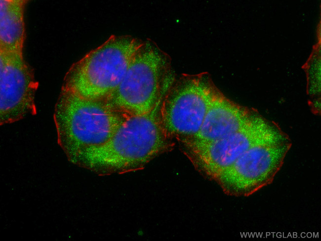 SNX16 Antibody in Immunocytochemistry (ICC/IF)