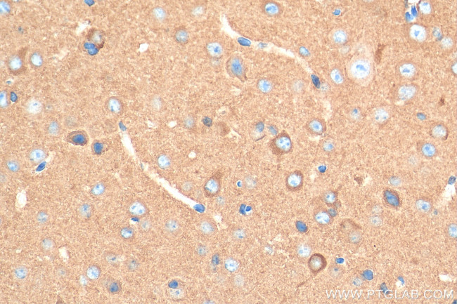 OXR1 Antibody in Immunohistochemistry (Paraffin) (IHC (P))