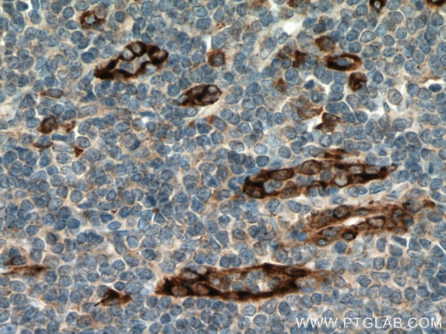 SPARCL1 Antibody in Immunohistochemistry (Paraffin) (IHC (P))
