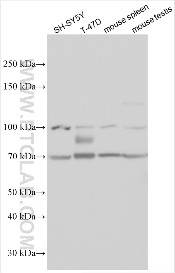Glypican 2 Antibody in Western Blot (WB)