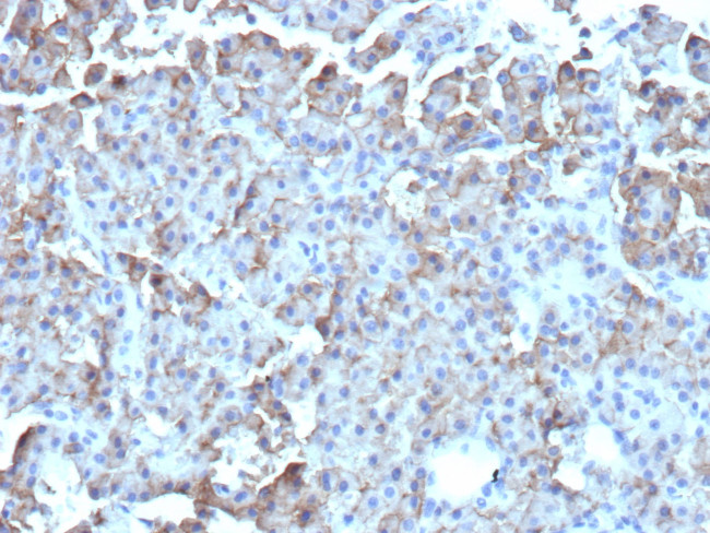 CD109 Antibody in Immunohistochemistry (Paraffin) (IHC (P))