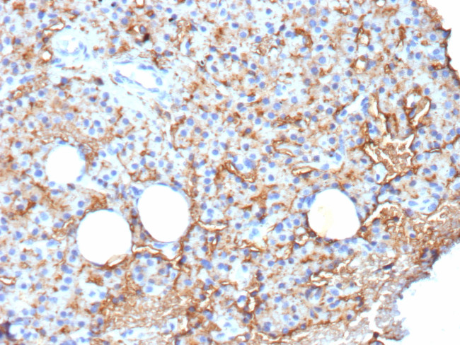 CD109 Antibody in Immunohistochemistry (Paraffin) (IHC (P))