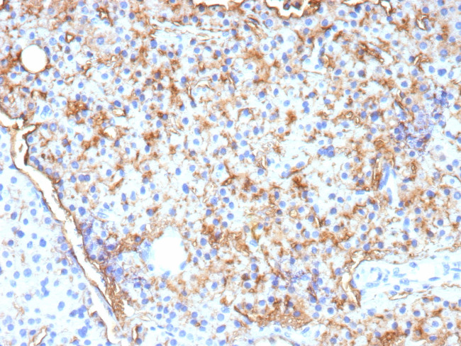 CD109 Antibody in Immunohistochemistry (Paraffin) (IHC (P))