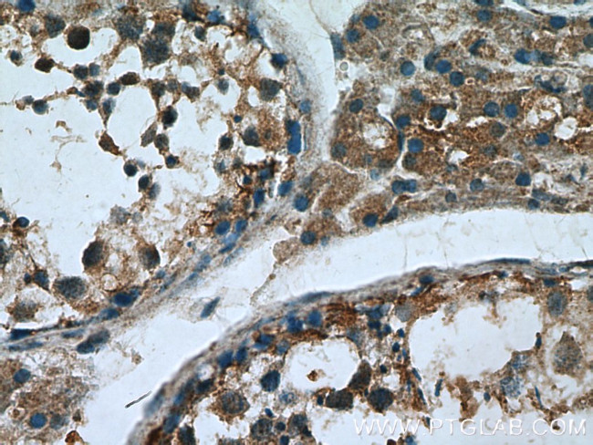 Proenkephalin-A Antibody in Immunohistochemistry (Paraffin) (IHC (P))