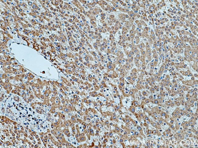 HMGCR Antibody in Immunohistochemistry (Paraffin) (IHC (P))