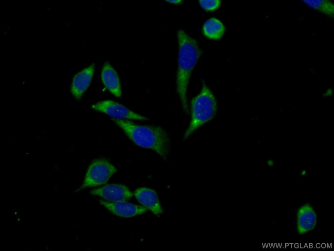 FSCN3 Antibody in Immunocytochemistry (ICC/IF)