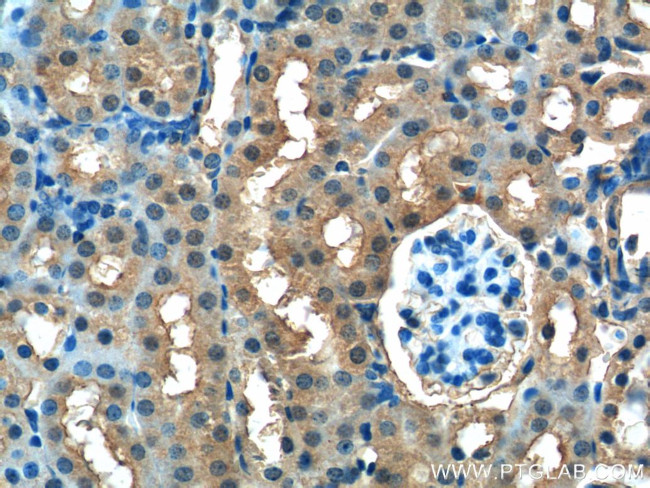 FUK Antibody in Immunohistochemistry (Paraffin) (IHC (P))