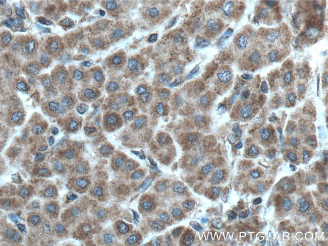 PDSS2 Antibody in Immunohistochemistry (Paraffin) (IHC (P))