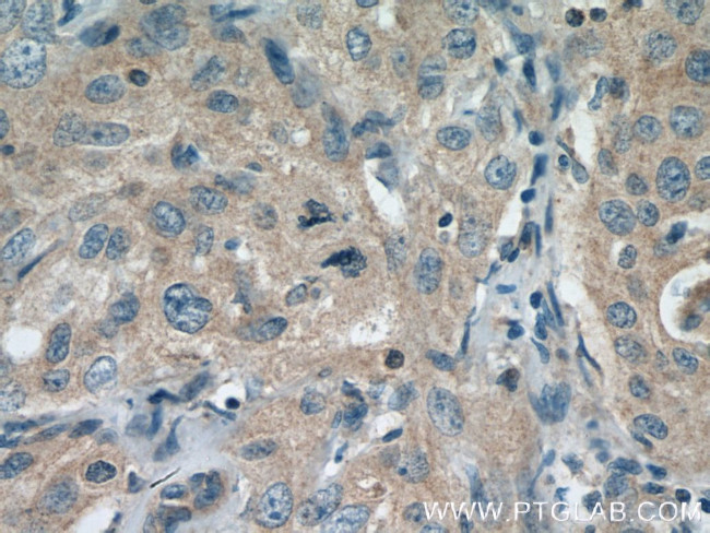 COG7 Antibody in Immunohistochemistry (Paraffin) (IHC (P))