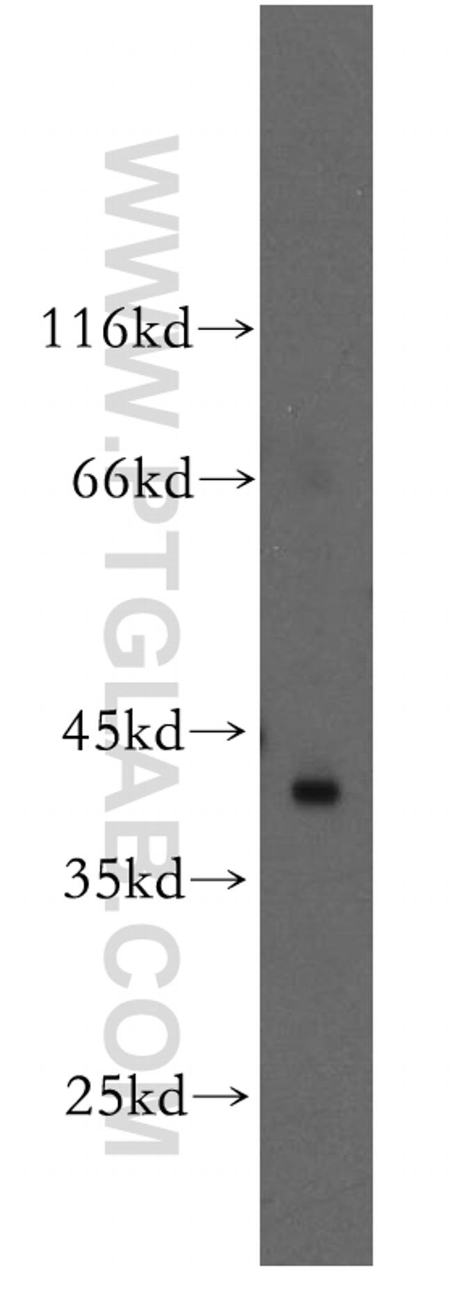 RAD51L1 Antibody in Western Blot (WB)