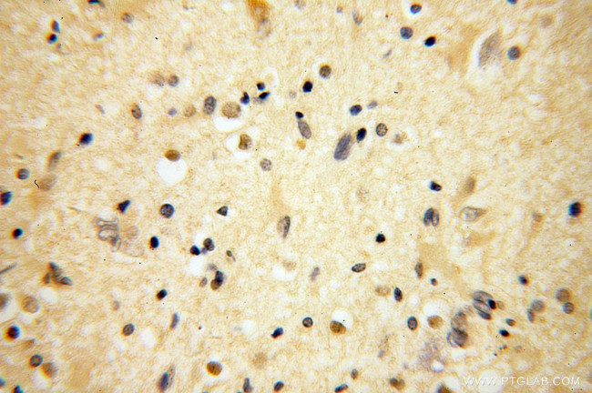 BRUNOL5 Antibody in Immunohistochemistry (Paraffin) (IHC (P))