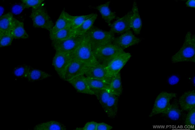 BST2 Antibody in Immunocytochemistry (ICC/IF)