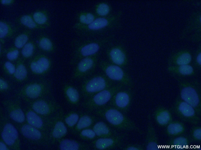 TLK1 Antibody in Immunocytochemistry (ICC/IF)