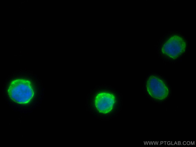 FcR gamma Antibody in Immunocytochemistry (ICC/IF)