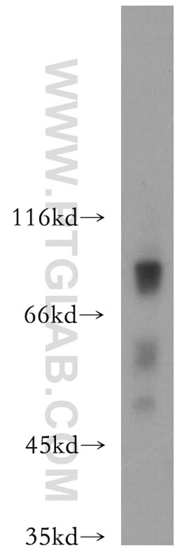 HCFC2 Antibody in Western Blot (WB)