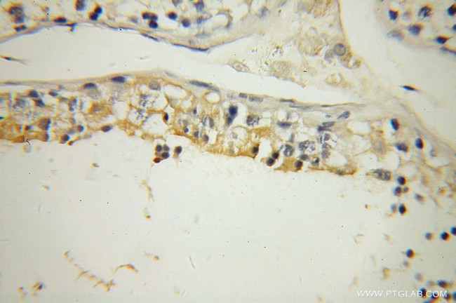 UBQLN3 Antibody in Immunohistochemistry (Paraffin) (IHC (P))