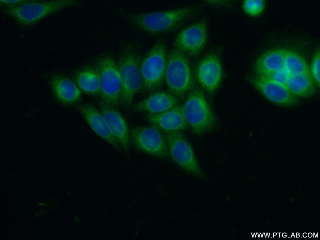 ARFGAP1 Antibody in Immunocytochemistry (ICC/IF)