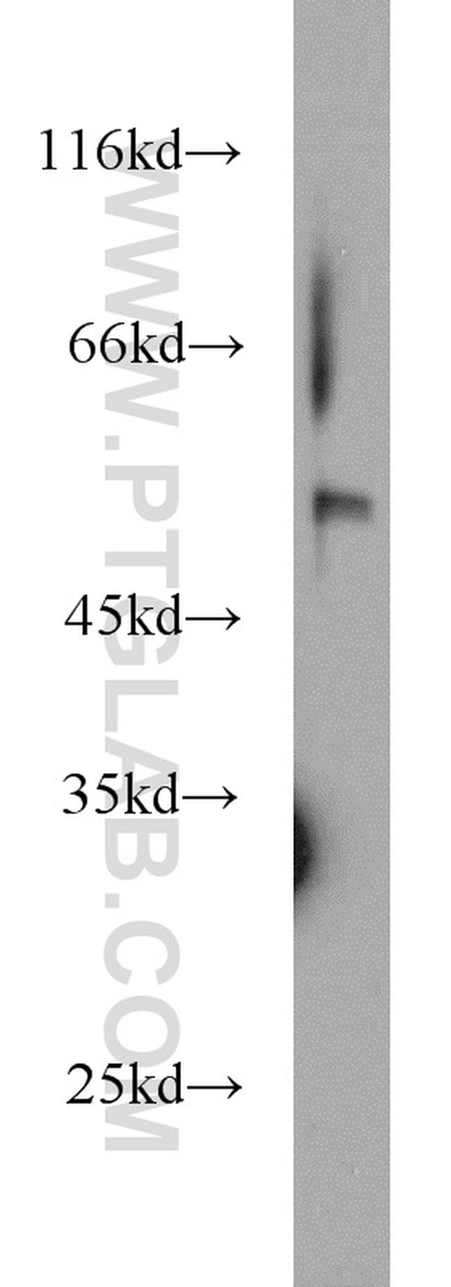 MNDA Antibody in Western Blot (WB)