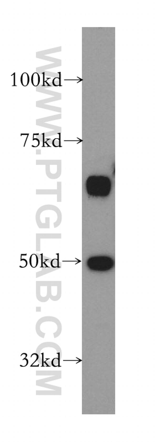 STK24 Antibody in Western Blot (WB)