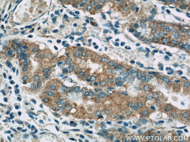 FAU Antibody in Immunohistochemistry (Paraffin) (IHC (P))