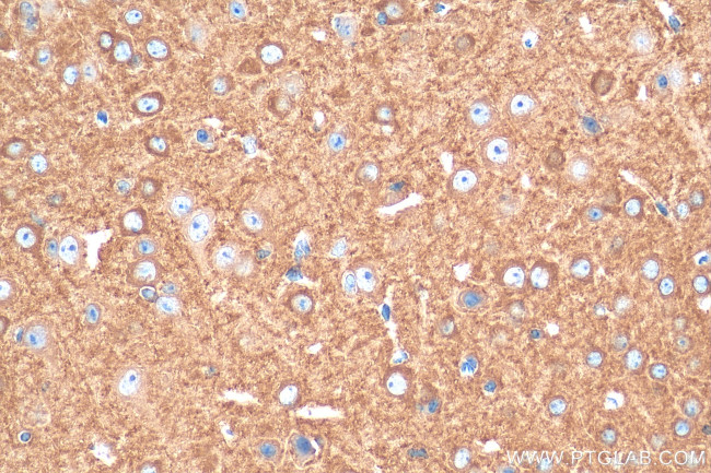 MPP2 Antibody in Immunohistochemistry (Paraffin) (IHC (P))