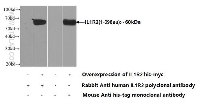 IL1R2 Antibody in Western Blot (WB)