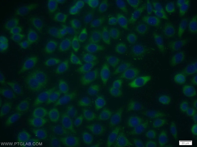 RIOK3 Antibody in Immunocytochemistry (ICC/IF)