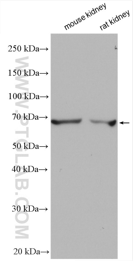SLC22A2 Antibody in Western Blot (WB)