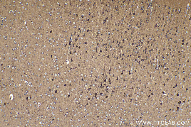 Cadherin-7 Antibody in Immunohistochemistry (Paraffin) (IHC (P))