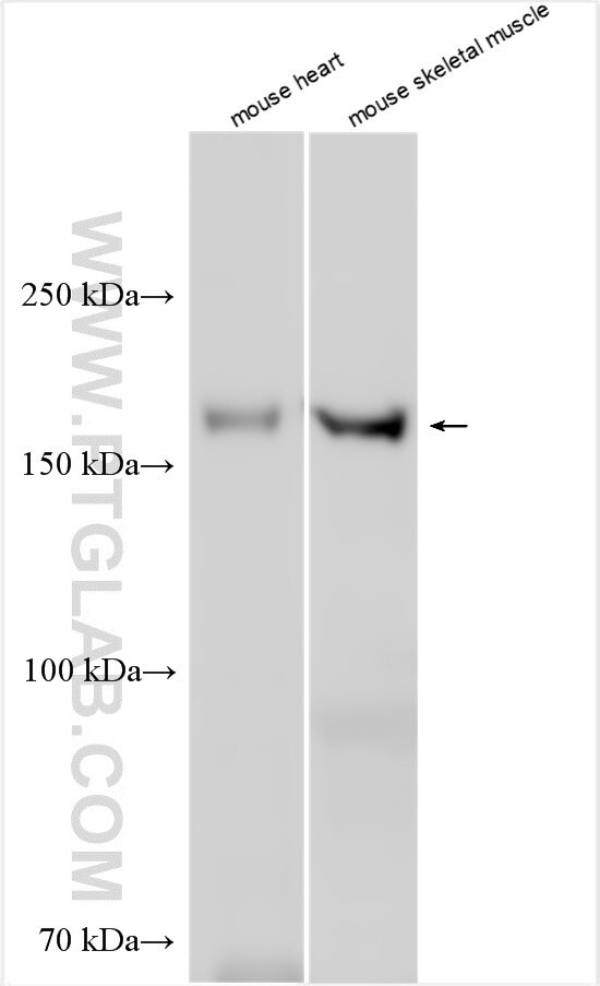 SUR2/ABCC9 Antibody in Western Blot (WB)