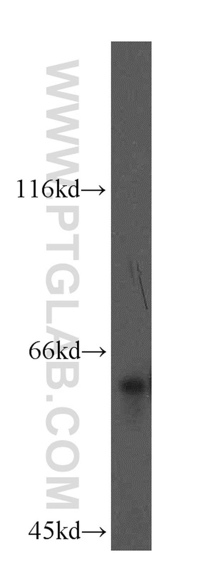 LSAMP Antibody in Western Blot (WB)