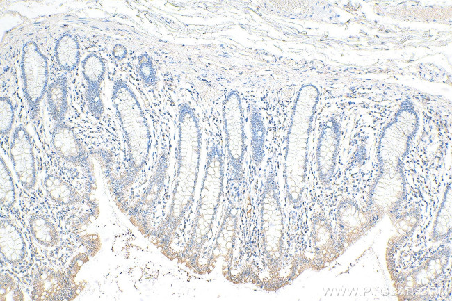 ITM2C Antibody in Immunohistochemistry (Paraffin) (IHC (P))