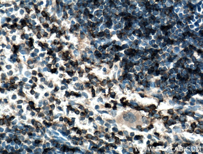 CD122/IL2RB Antibody in Immunohistochemistry (Paraffin) (IHC (P))