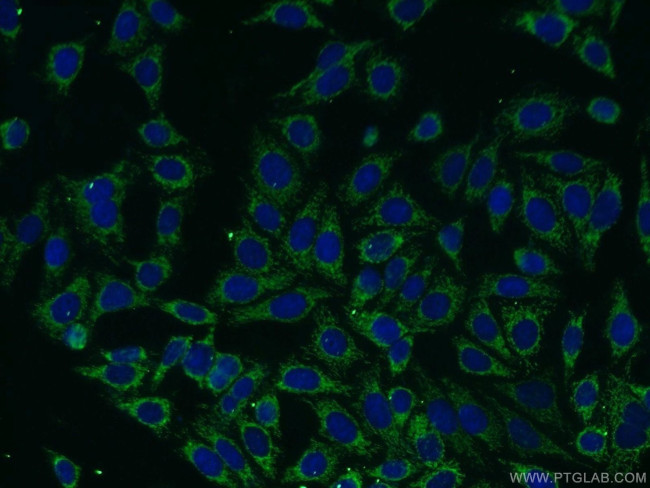 Carboxypeptidase A6 Antibody in Immunocytochemistry (ICC/IF)