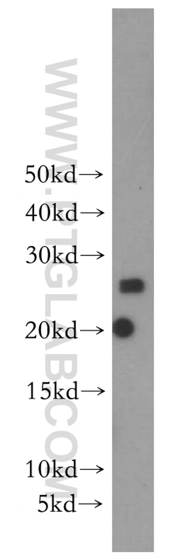SCN2B Antibody in Western Blot (WB)