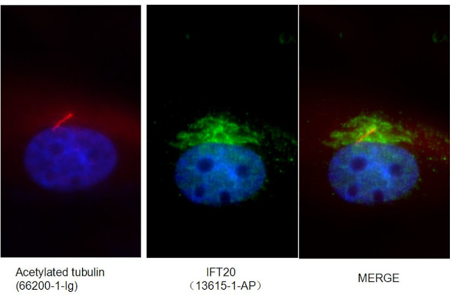 IFT20 Antibody in Immunocytochemistry (ICC/IF)