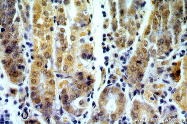 RASGEF1B Antibody in Immunohistochemistry (Paraffin) (IHC (P))