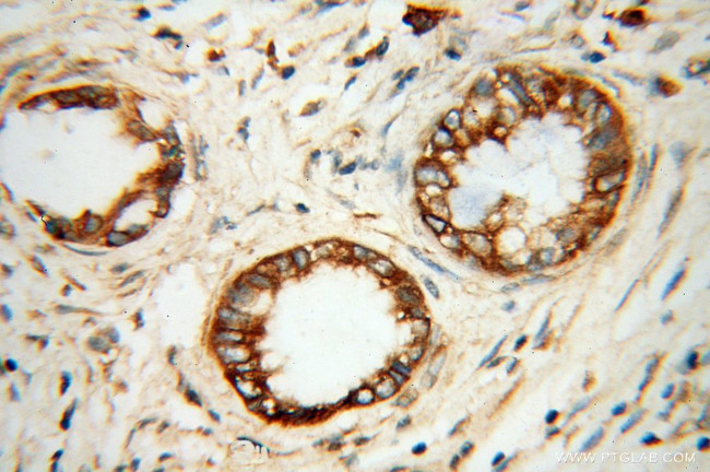 SERCA3 Antibody in Immunohistochemistry (Paraffin) (IHC (P))