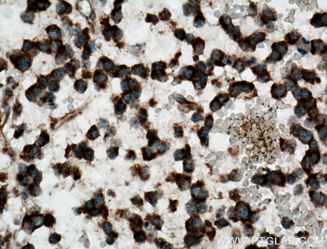 CAMKK1 Antibody in Immunohistochemistry (Paraffin) (IHC (P))