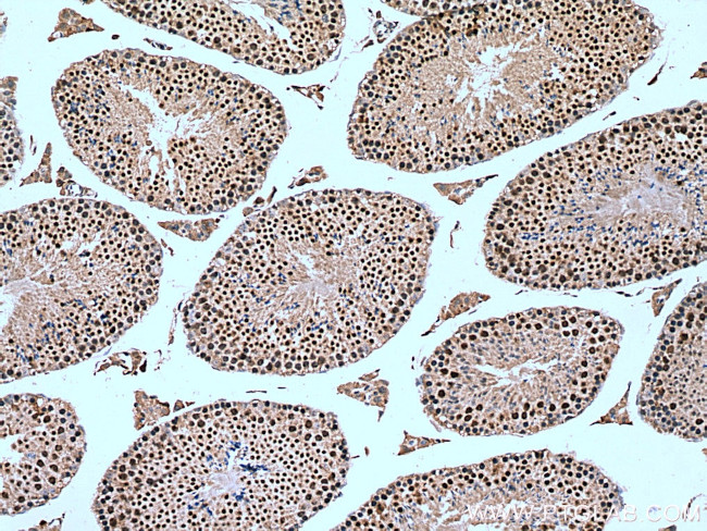 NSMCE2 Antibody in Immunohistochemistry (Paraffin) (IHC (P))