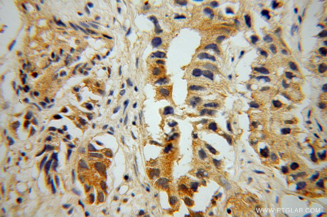 PNMA1 Antibody in Immunohistochemistry (Paraffin) (IHC (P))
