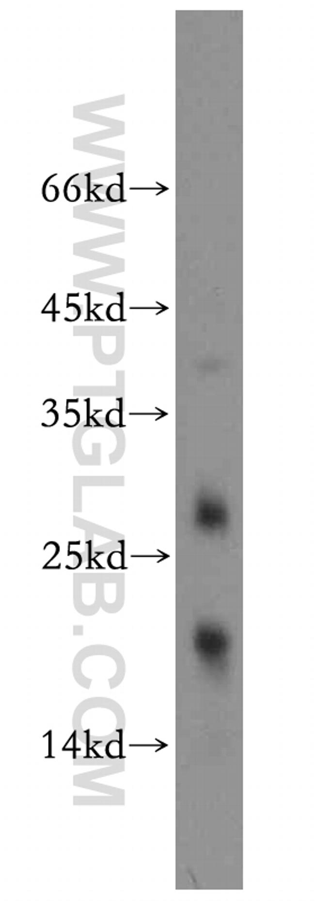 TPPP2 Antibody in Western Blot (WB)