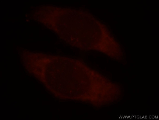 TROAP Antibody in Immunocytochemistry (ICC/IF)