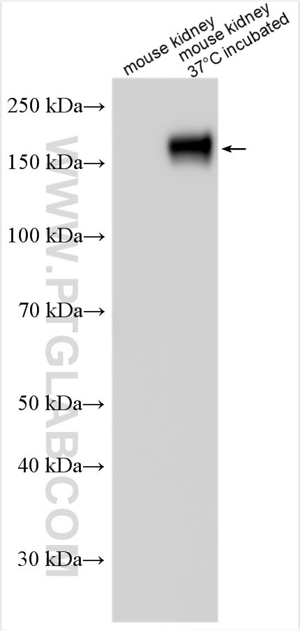 NKCC2 Antibody in Western Blot (WB)