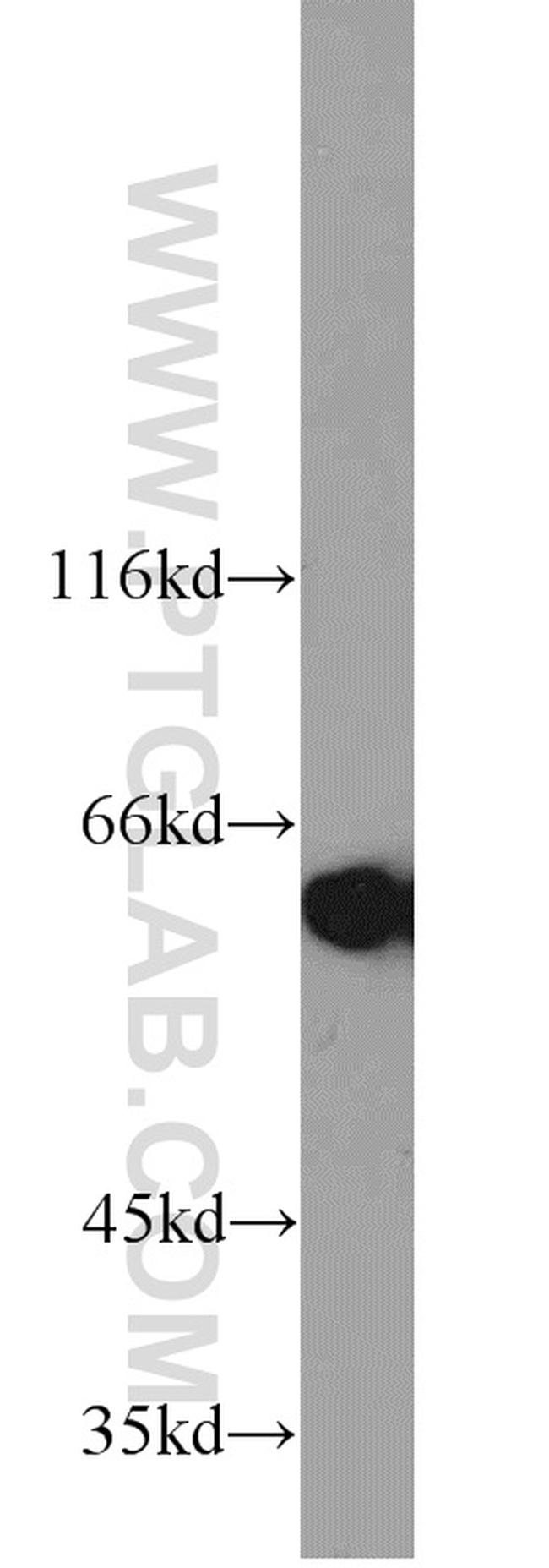 MAK Antibody in Western Blot (WB)