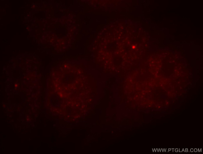 DSS1 Antibody in Immunocytochemistry (ICC/IF)