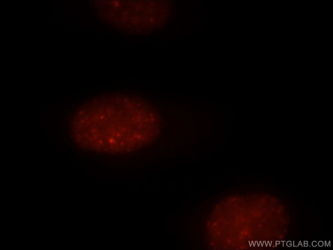 UIMC1 Antibody in Immunocytochemistry (ICC/IF)