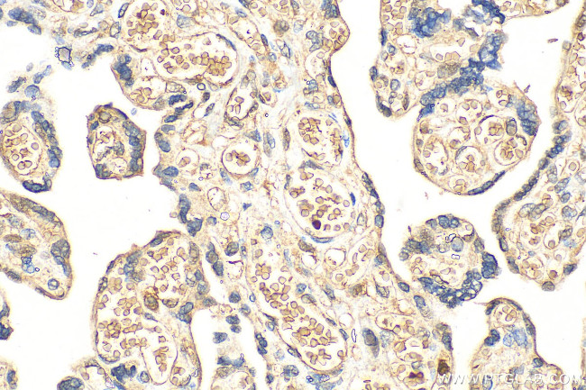 AHSP Antibody in Immunohistochemistry (Paraffin) (IHC (P))