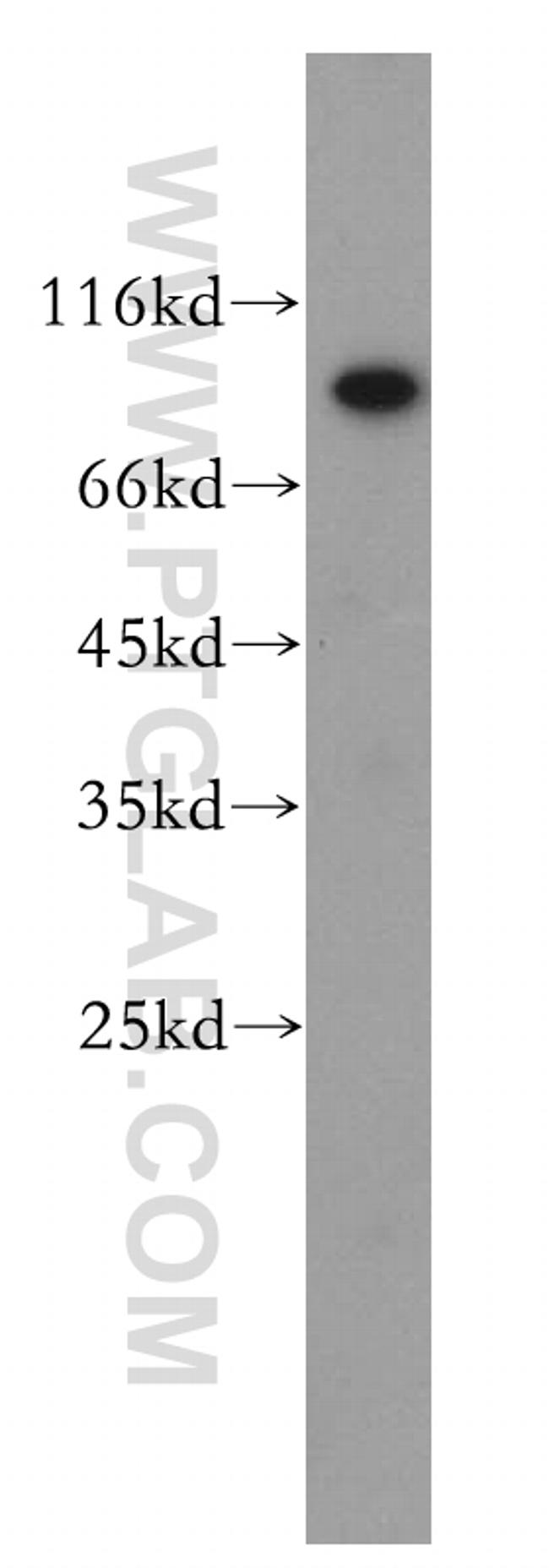 TIGD5 Antibody in Western Blot (WB)