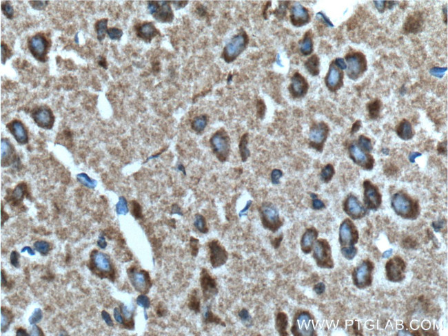 Syntaphilin Antibody in Immunohistochemistry (Paraffin) (IHC (P))